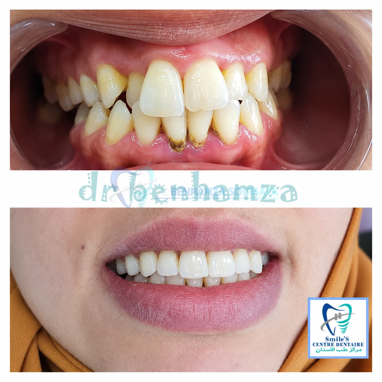 Orthodontie · cas clinique